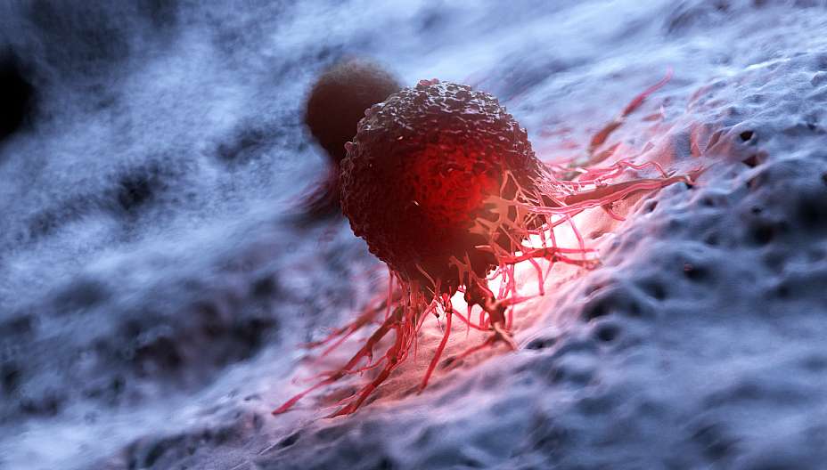 טיפולים מתקדמים בתחום הסרטן