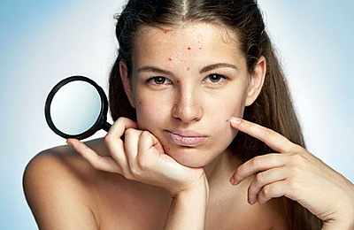 אישה עם פצעים ונקודות על הפנים