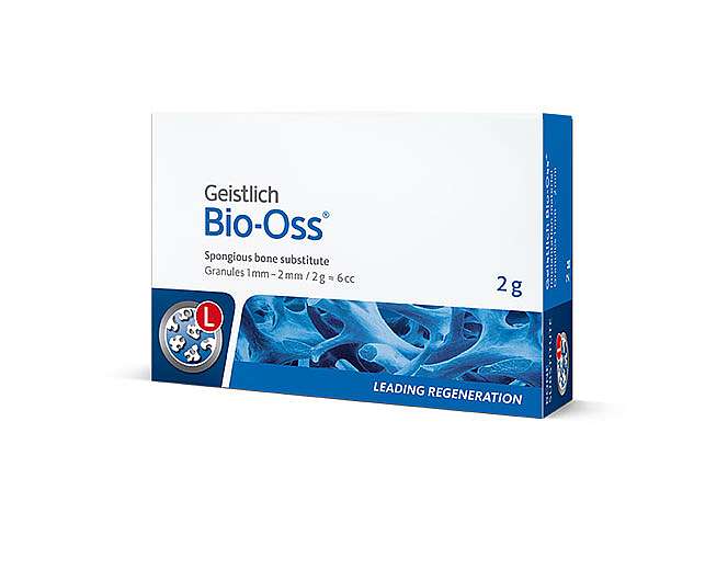 ביו-אוס Bio-Oss