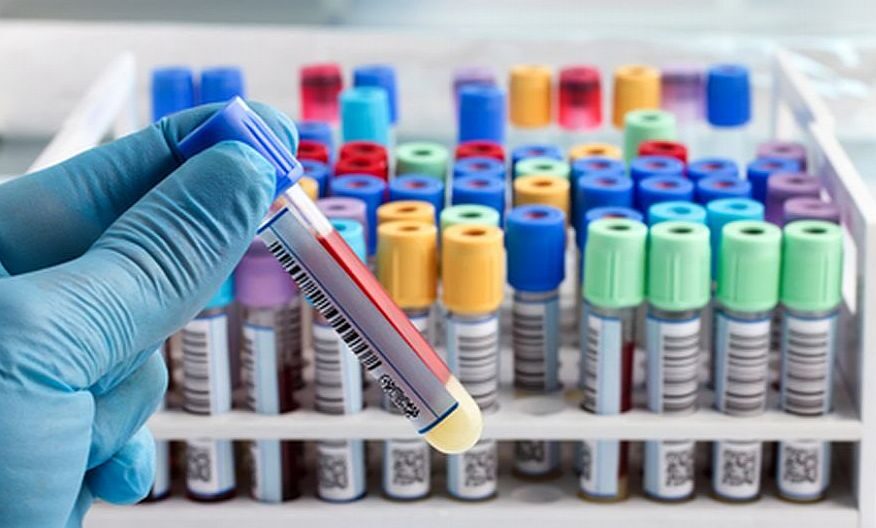 אבחון סרטן הערמונית