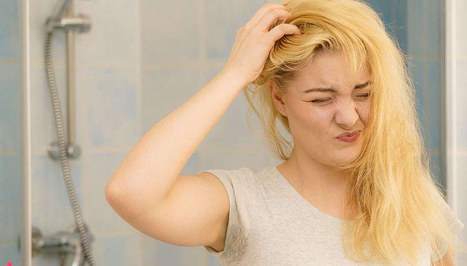 קשקשים כמה עובדות שכדאי להכיר